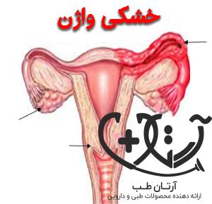 Vaginal dryness